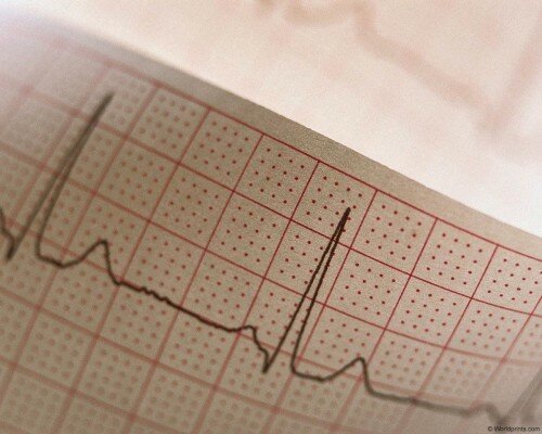 Медицинская диагностика инфаркта у мужчин