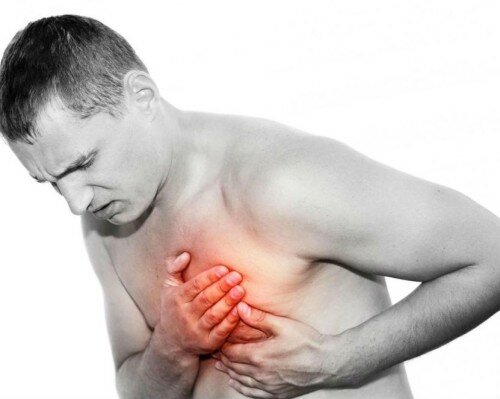 симптомы острого инфаркта миокарда