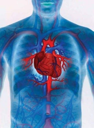 формы инфаркта миокарда